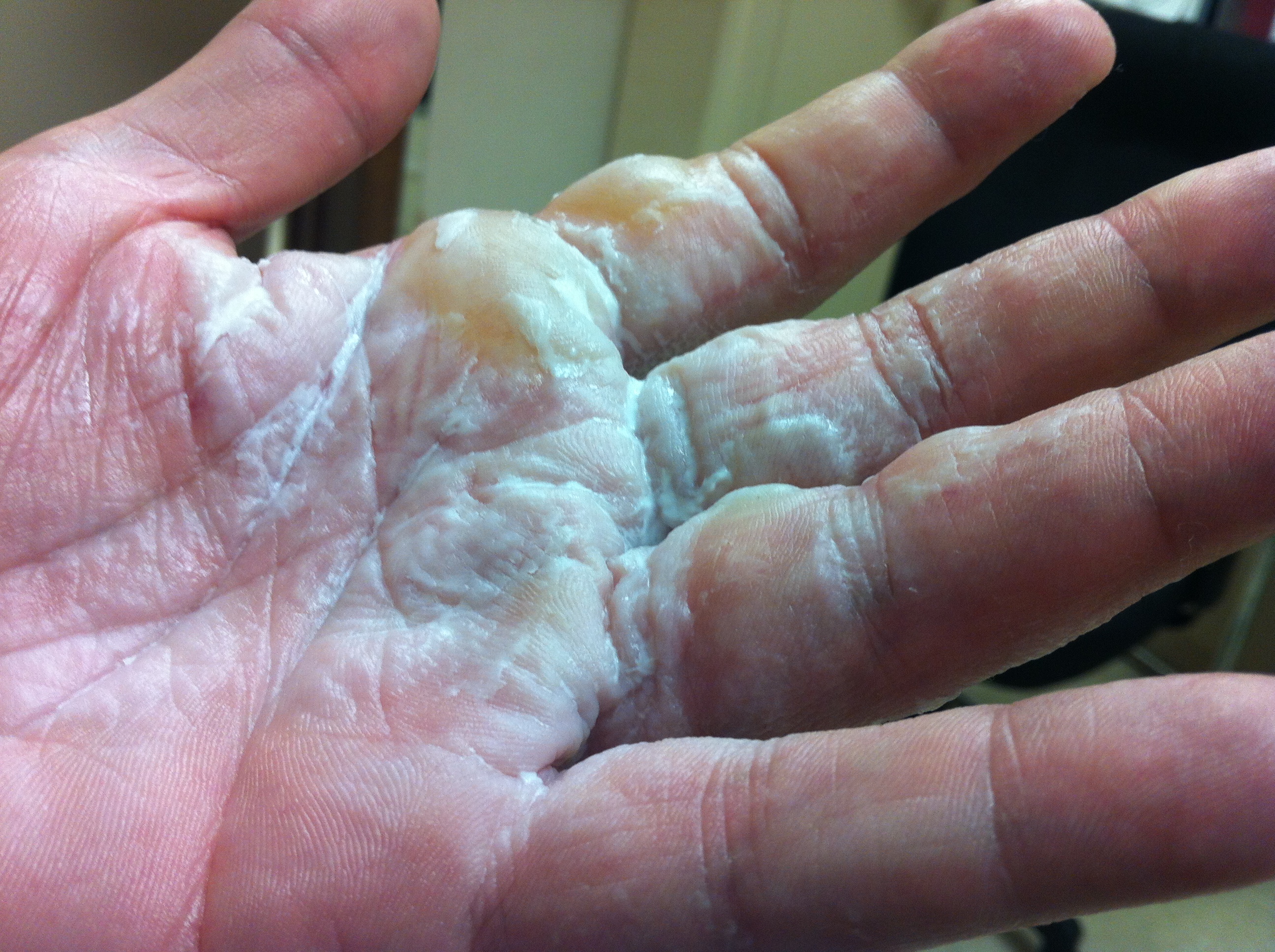 The Dangers Of Canned Air Hurricane Canless Air System